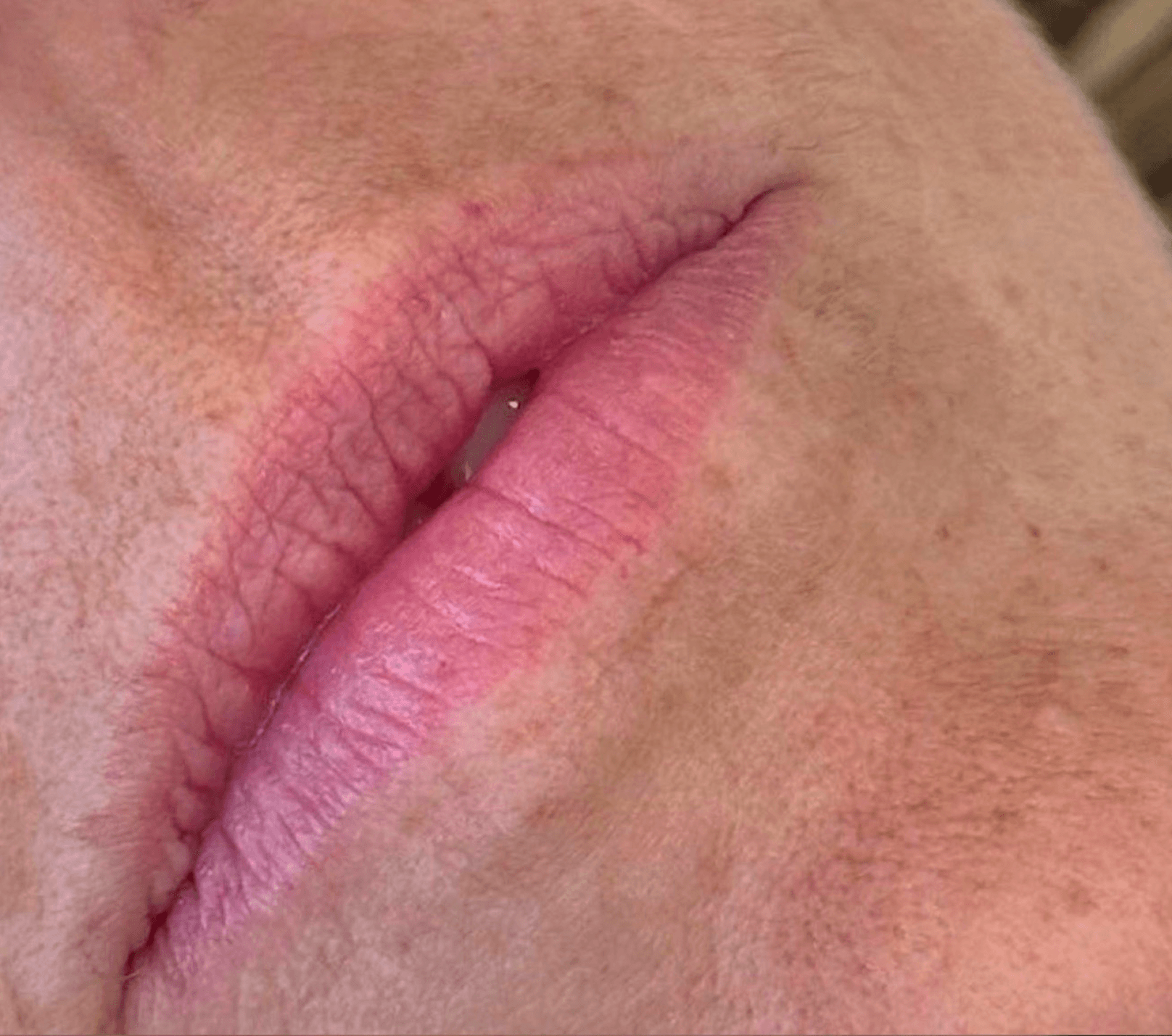 Lip Glow before