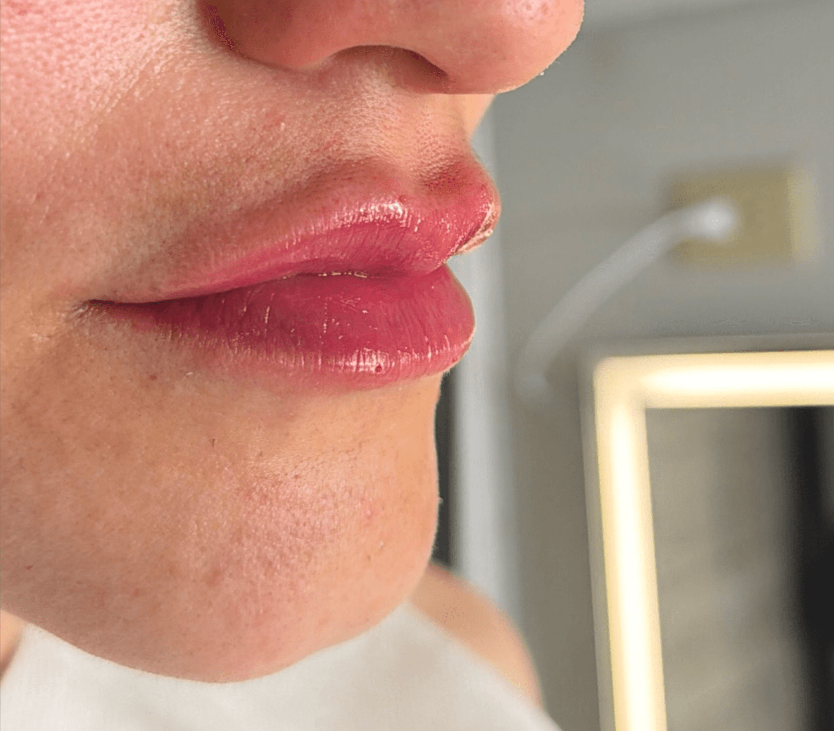 Facial Contour after